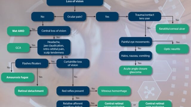 Acute Vision Loss – Evaluating Acute Vision Loss