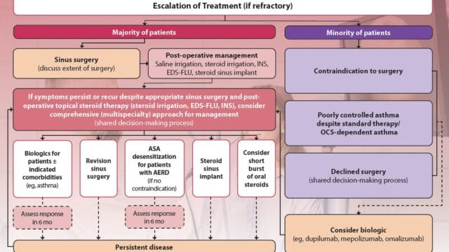 CRSwNP – Stepwise Treatment Algorithm for Management of CRSwNP