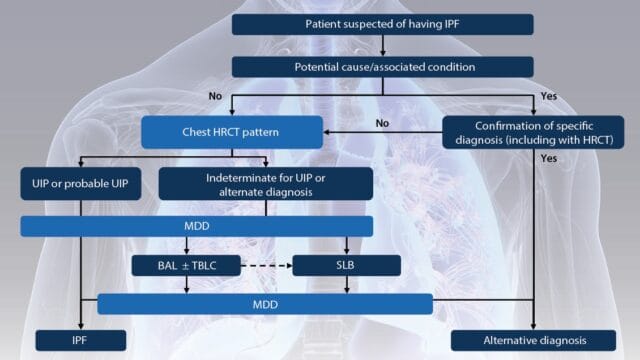 ILD – Diagnostic Algorithm for Suspected IPF