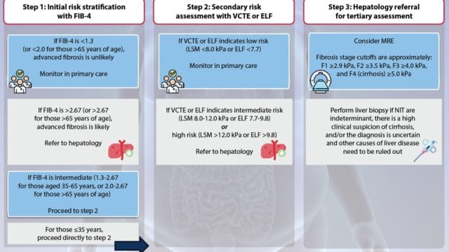 MASH & MASLD – Stepwise Algorithm for Noninvasive Testing for MASH & MASLD