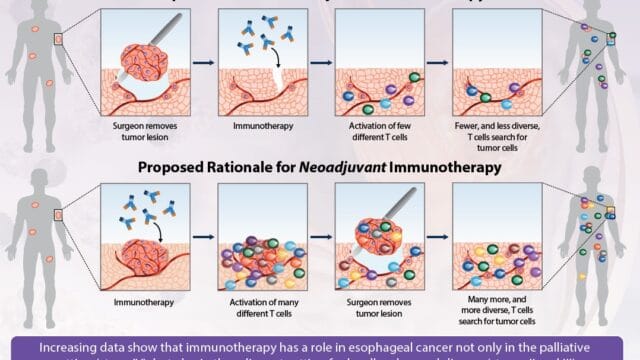 Rationale for Combined Modality Therapy in Localized Gastric & GEJ Cancer